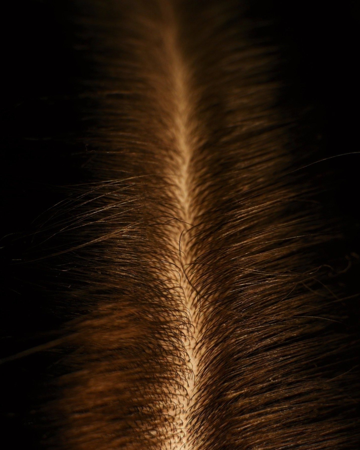 Close-up of a straight part in dense dark brown hair, the scalp visible along the part.