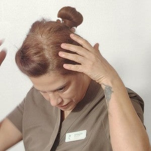 Revi parts her hair with her fingers so the skin of the scalp shows
